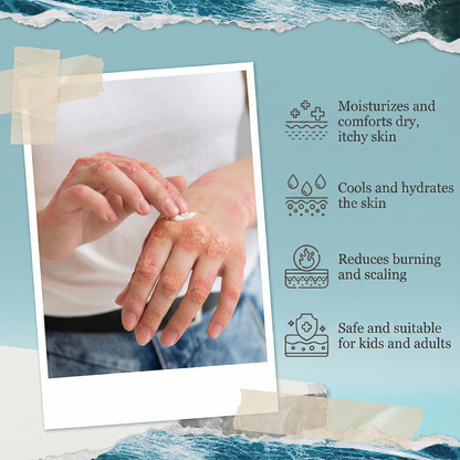 Natural Eczema & Psoriasis Relief Cream – Sea Moss & Oatmeal