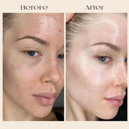 FavoPrime™ Arbutin 7% + Tranexamic Acid 4% Cream